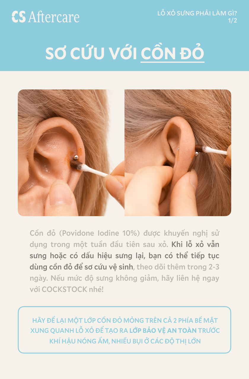 Sơ cứu với cồn đỏ Povidone Iodine